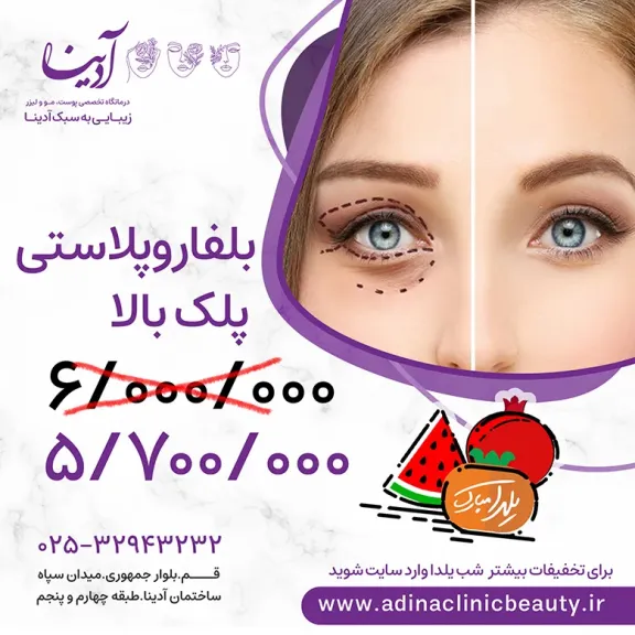 تخفیف شب یلدا 4